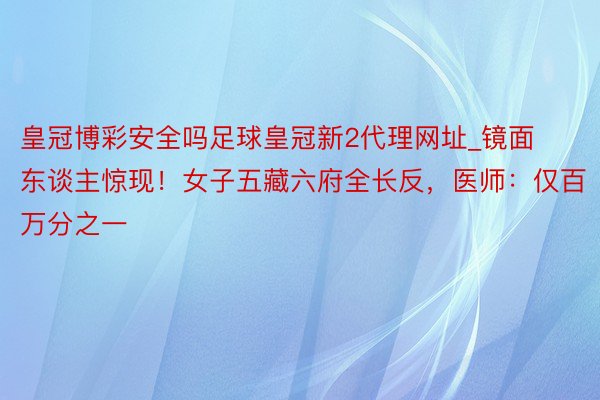皇冠博彩安全吗足球皇冠新2代理网址_镜面东谈主惊现！女子五藏六府全长反，医师：仅百万分之一
